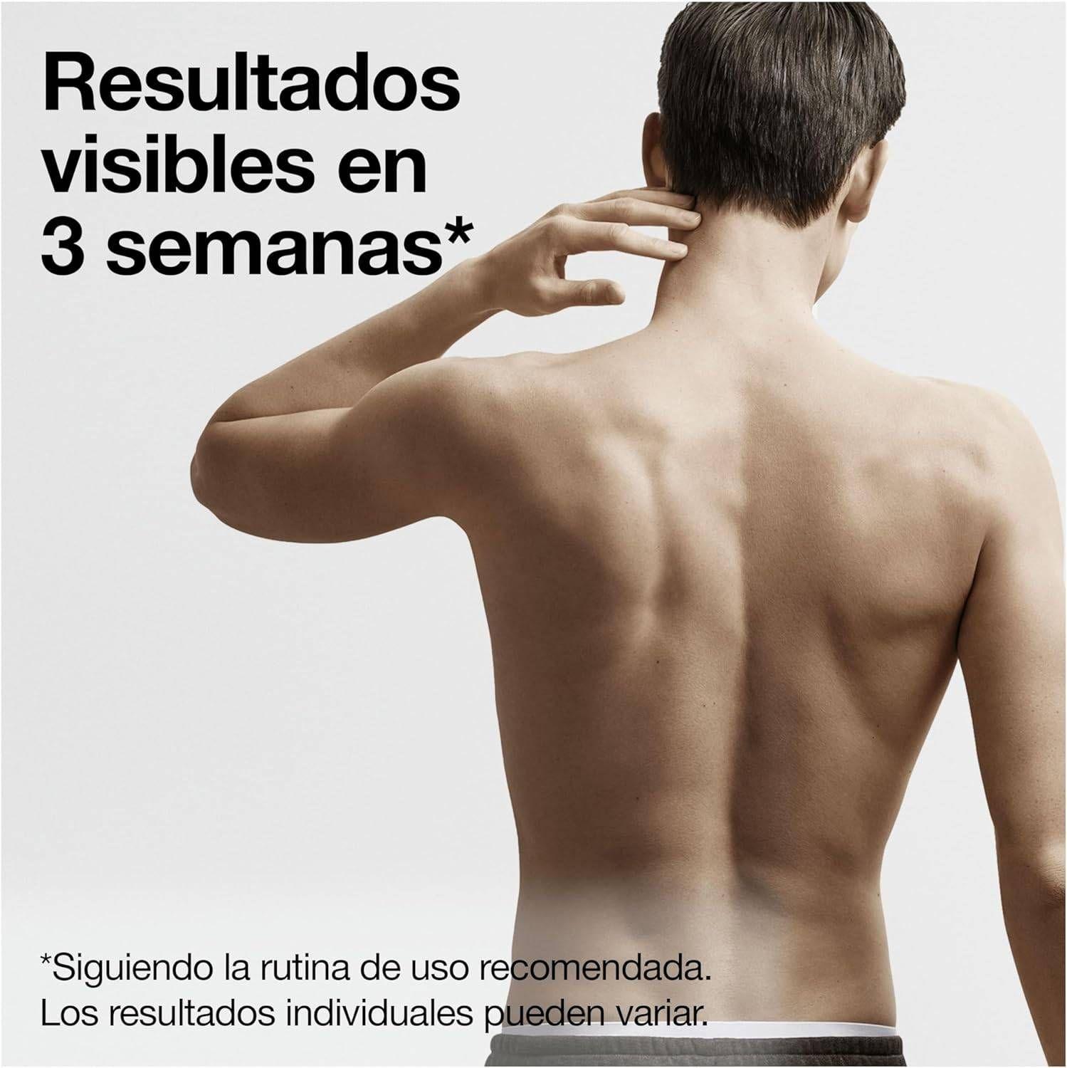 Depiladora IPL BRAUN PL5145 Silk-expert Pro 5 (Branco), miniatura 5